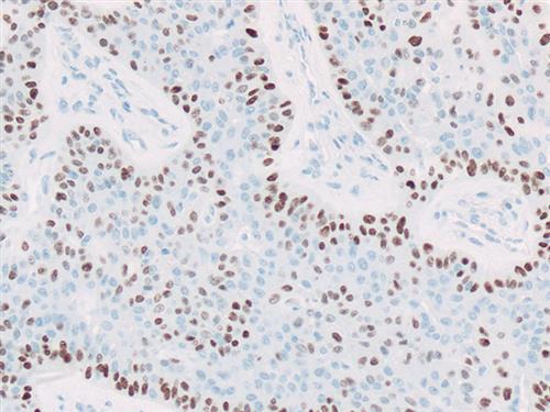 3635A | Control Slides:Immunopathology; p40